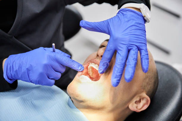 Best Dentist for Tooth Abscess  in Rushville, IN